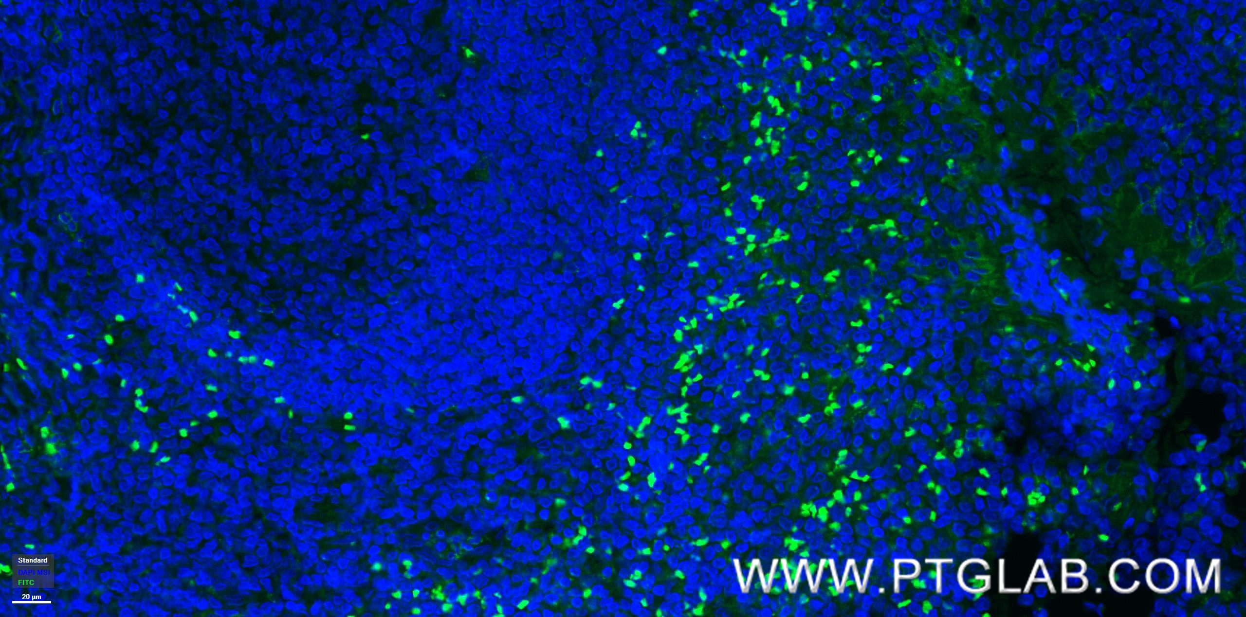 IF Staining of human tonsillitis using 83919-4-RR (same clone as 83919-4-PBS)