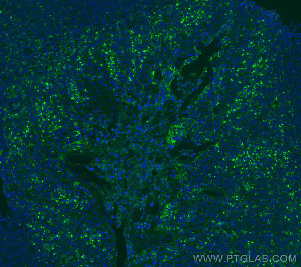 IF Staining of human tonsillitis using 83919-4-RR (same clone as 83919-4-PBS)