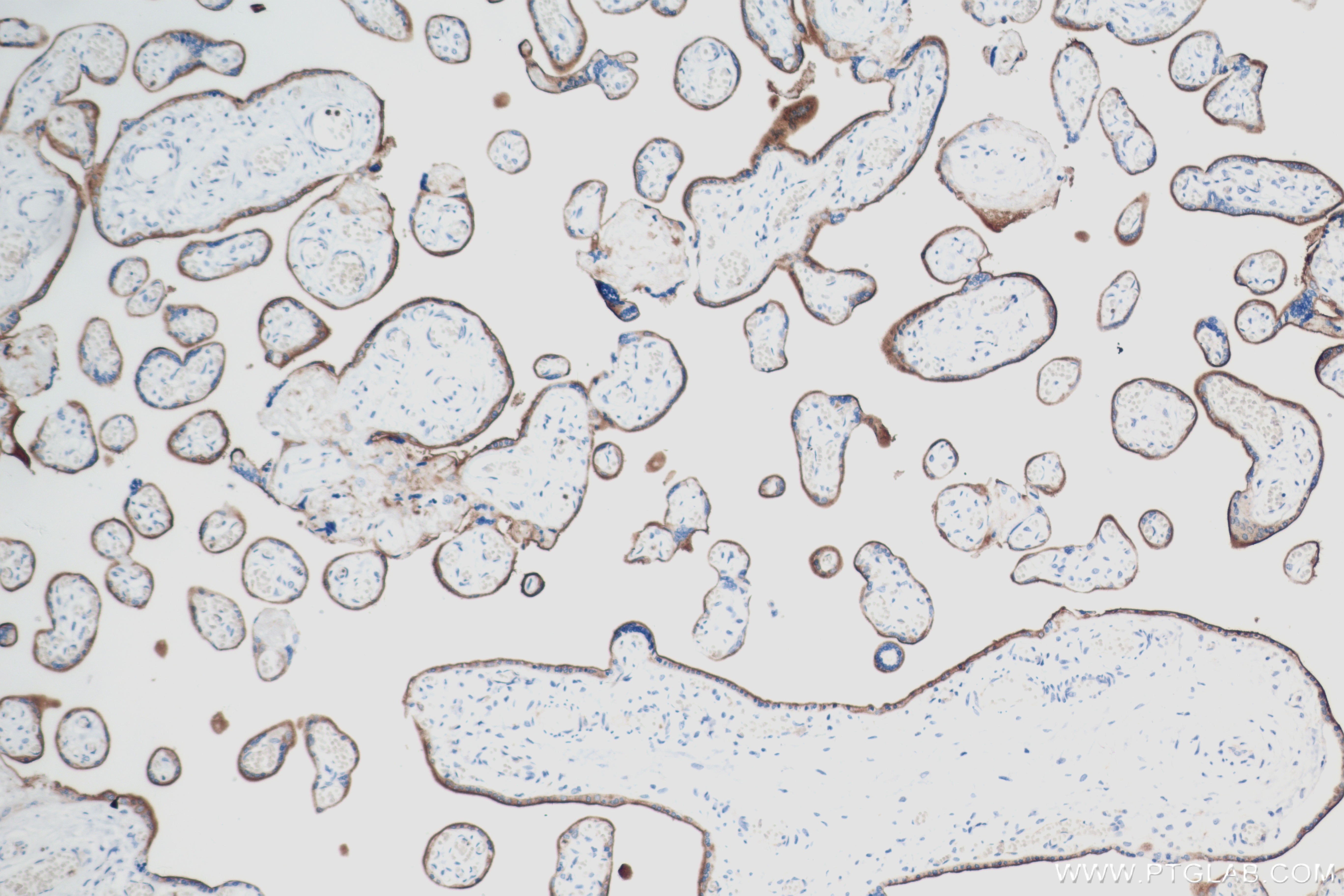 IHC staining of human placenta using 83919-4-RR (same clone as 83919-4-PBS)