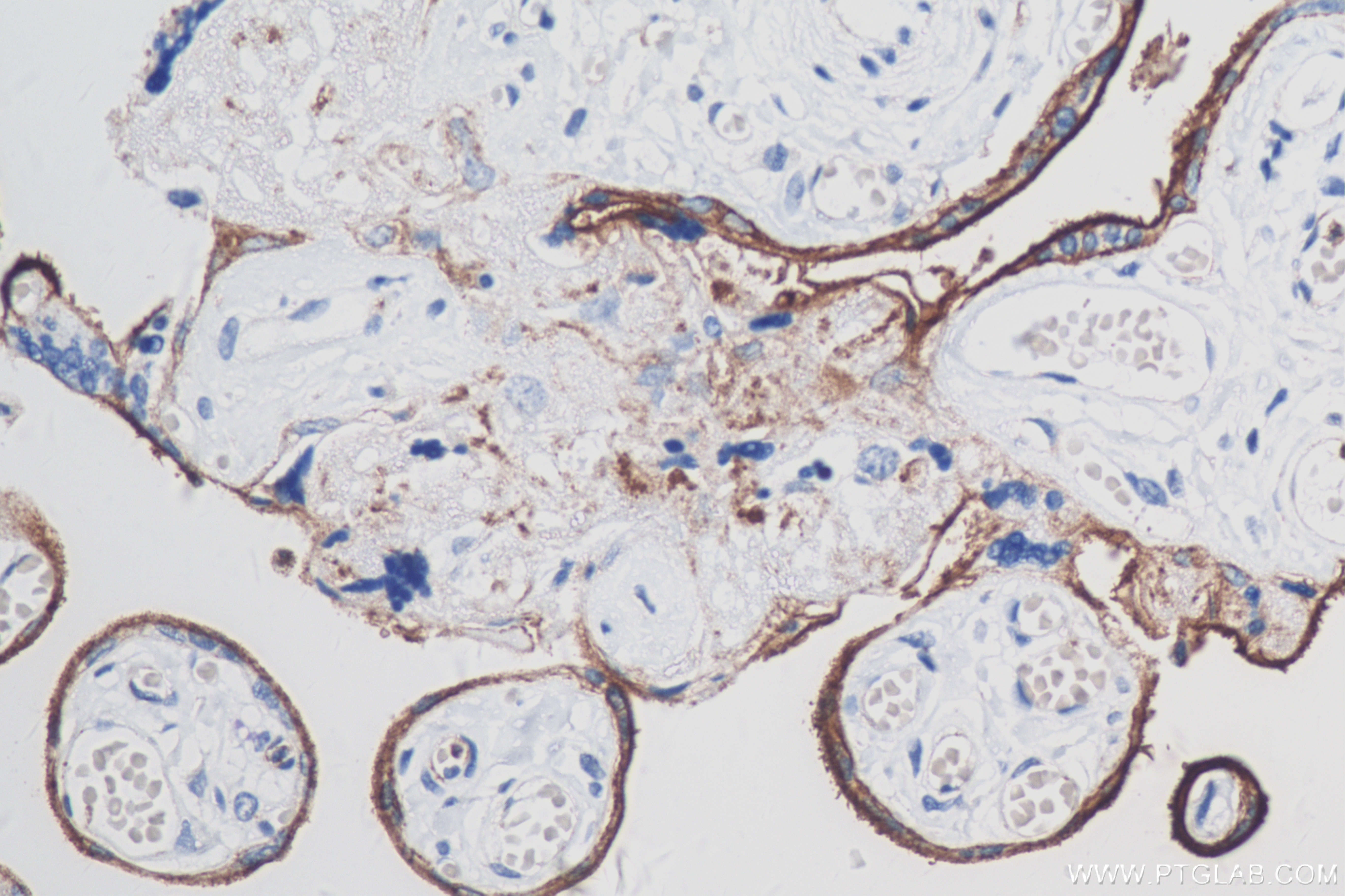 IHC staining of human placenta using 83919-4-RR (same clone as 83919-4-PBS)