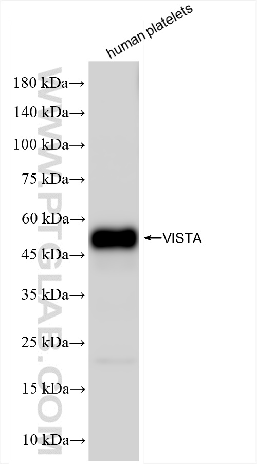 WB analysis of human peripheral blood platelets using 83919-4-RR (same clone as 83919-4-PBS)