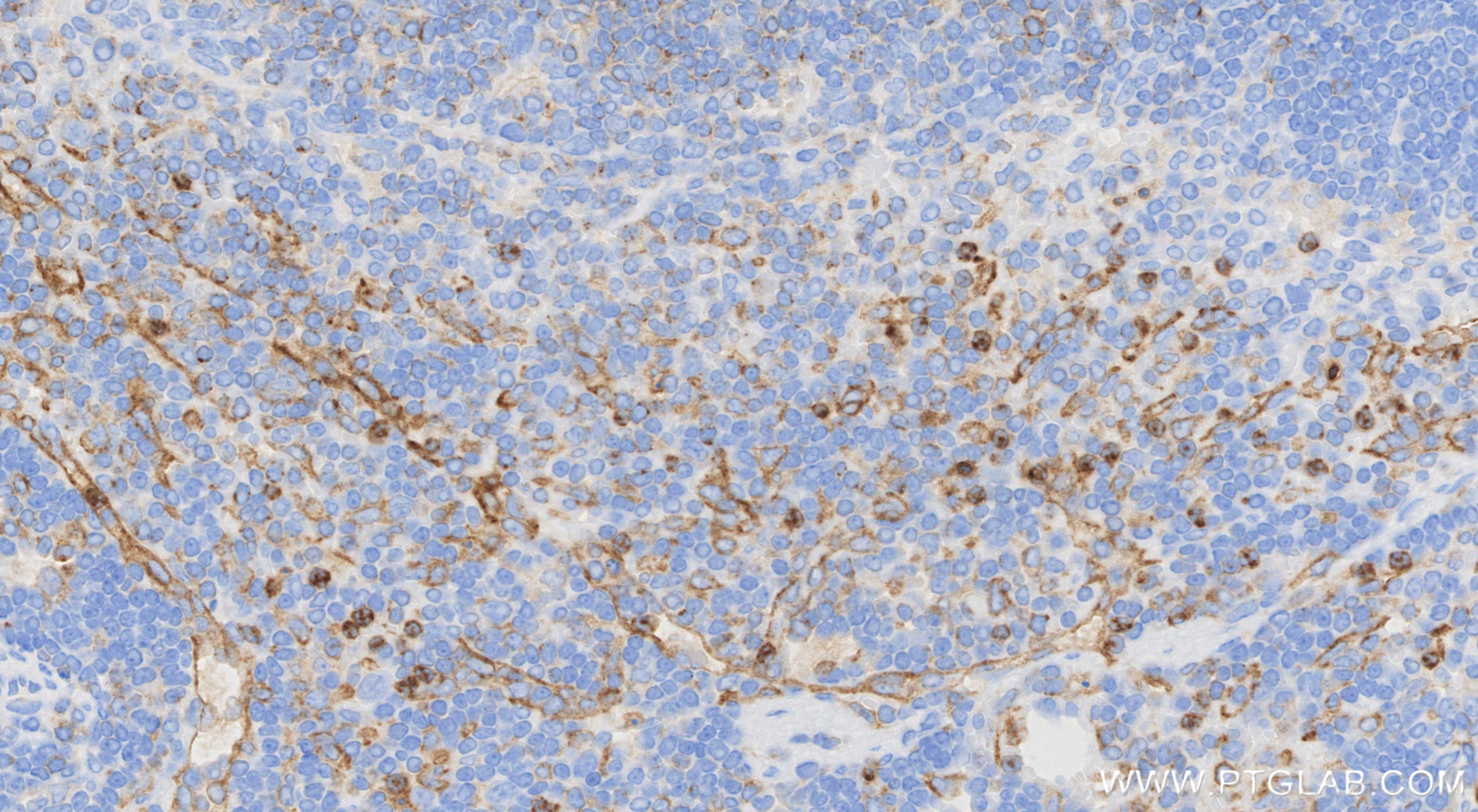 IHC staining of mouse spleen using 86114-3-RR