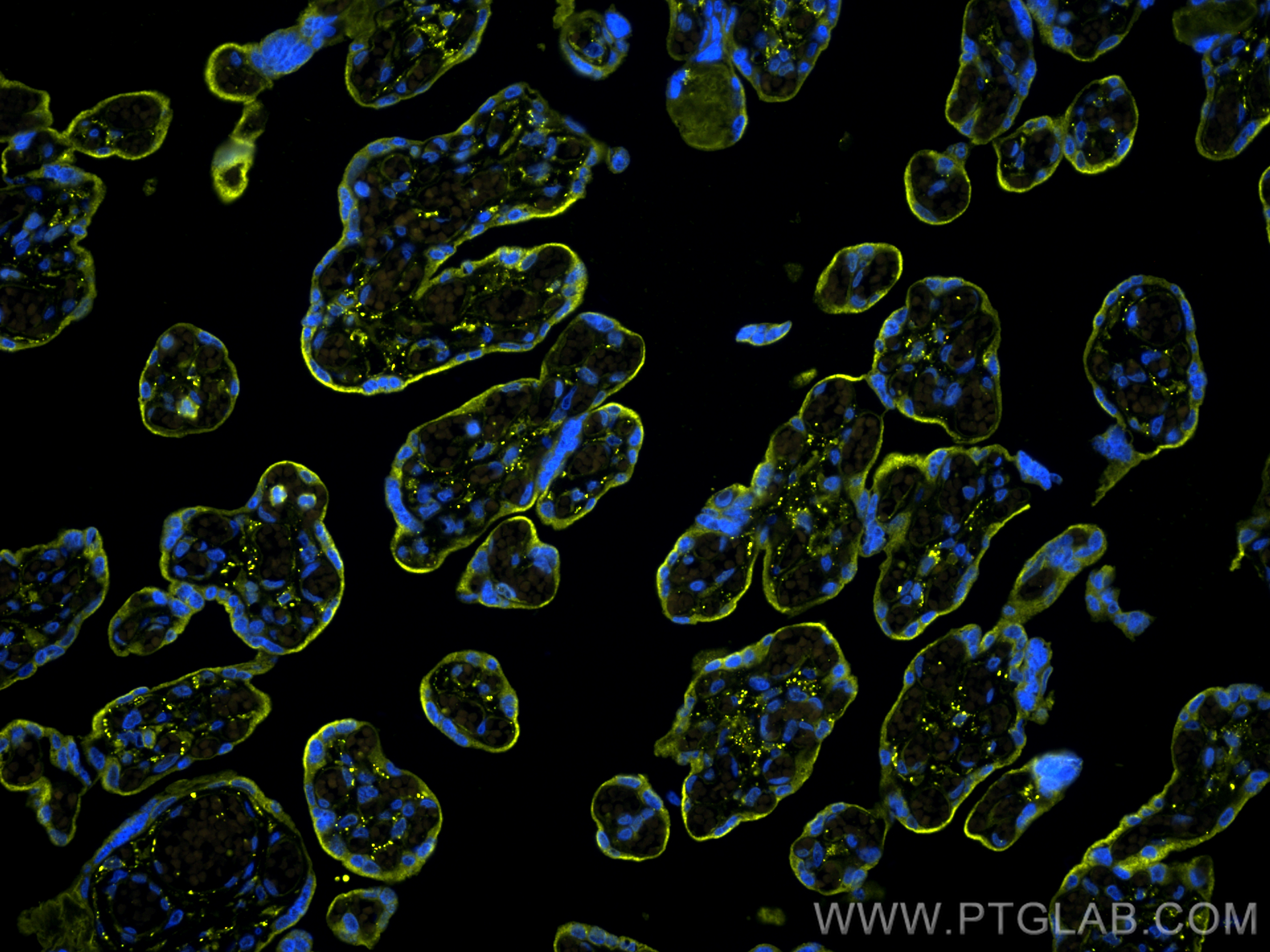 IF Staining of human placenta using CL532-24849