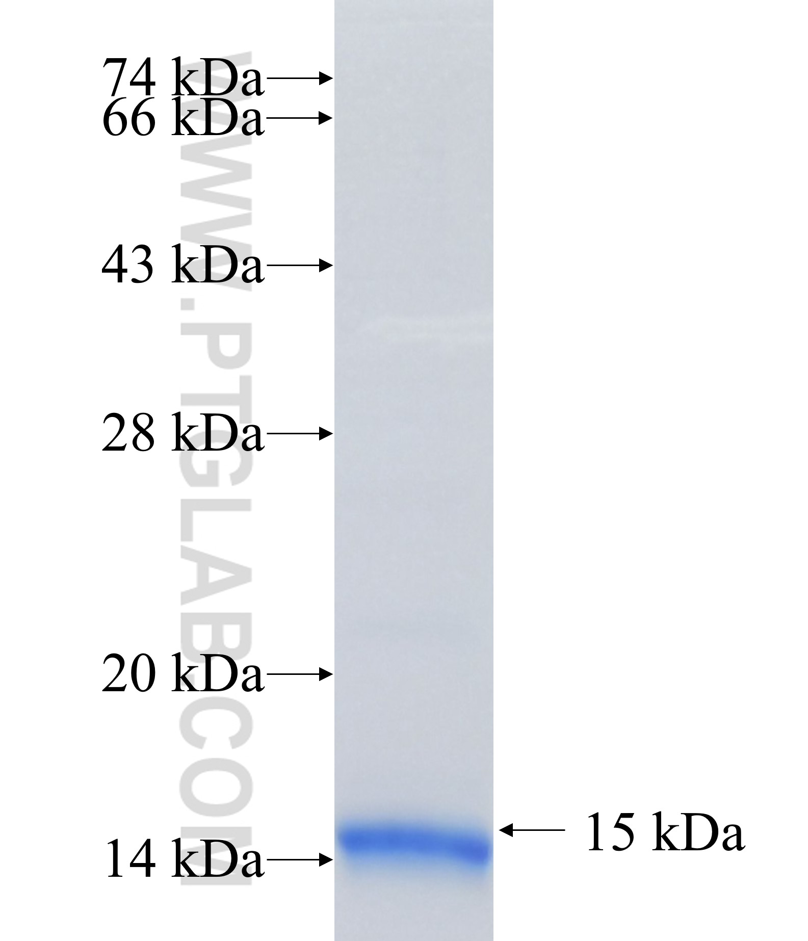 VKORC1 fusion protein Ag14378 SDS-PAGE