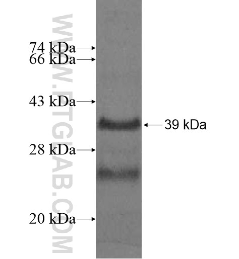 VKORC1L1 fusion protein Ag10296 SDS-PAGE VKORC1L1 fusion protein Ag10296 SDS-PAGE