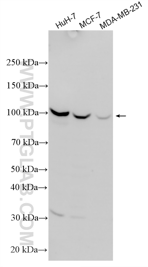 Various lysates were subjected to SDS PAGE followed by western blot with 19493-1-AP (VLDLR antibody) at dilution of 1:4000 incubated at room temperature for 1.5 hours. WB analysis using 19493-1-AP