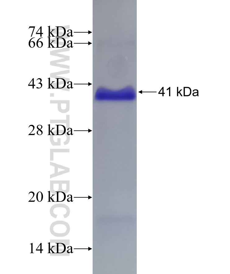 VLDLR fusion protein Ag28835 SDS-PAGE VLDLR fusion protein Ag28835 SDS-PAGE