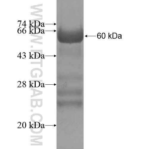VLDLR fusion protein Ag15533 SDS-PAGE VLDLR fusion protein Ag15533 SDS-PAGE