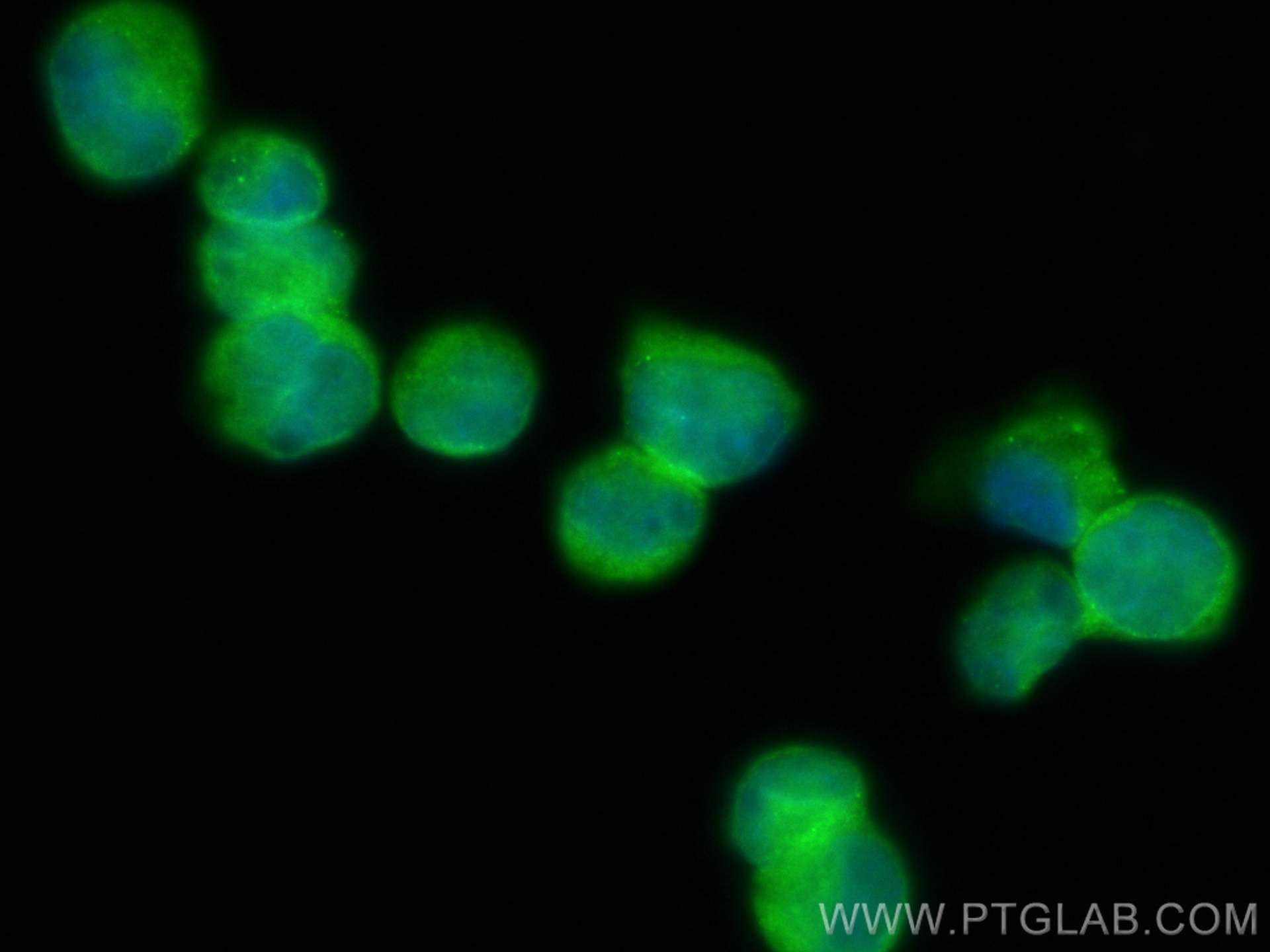 IF Staining of K-562 using 31628-1-AP