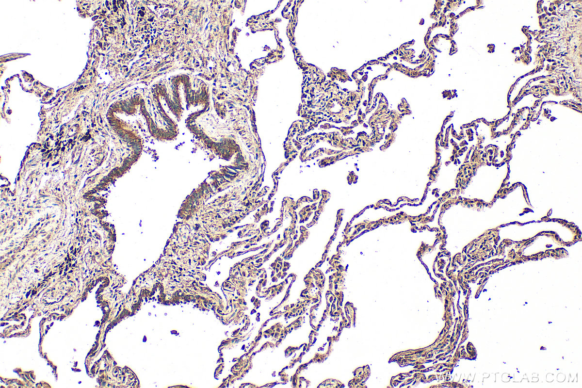IHC staining of human lung using 31628-1-AP