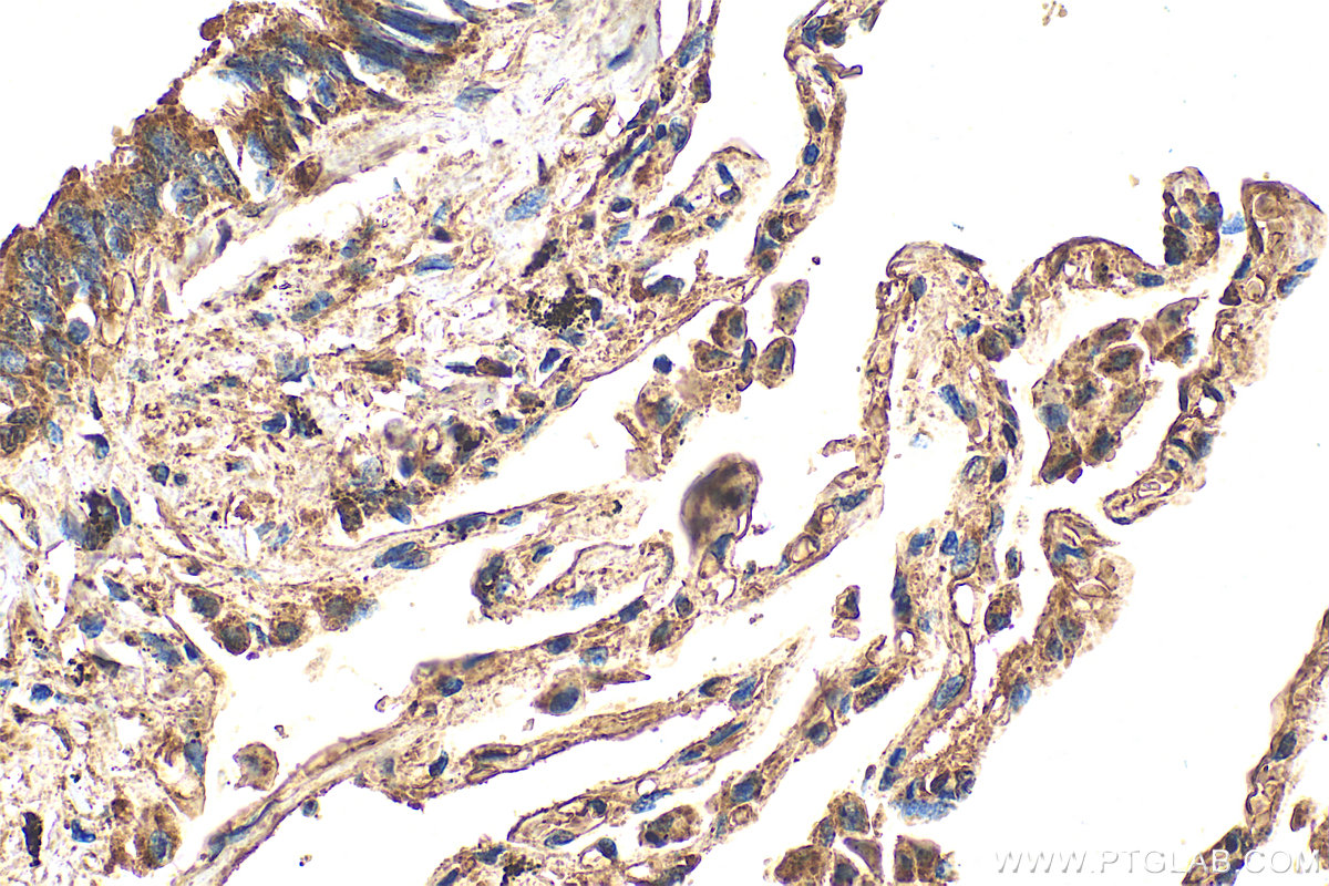 IHC staining of human lung using 31628-1-AP