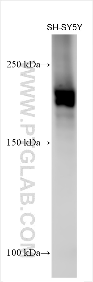 WB analysis using 31628-1-AP
