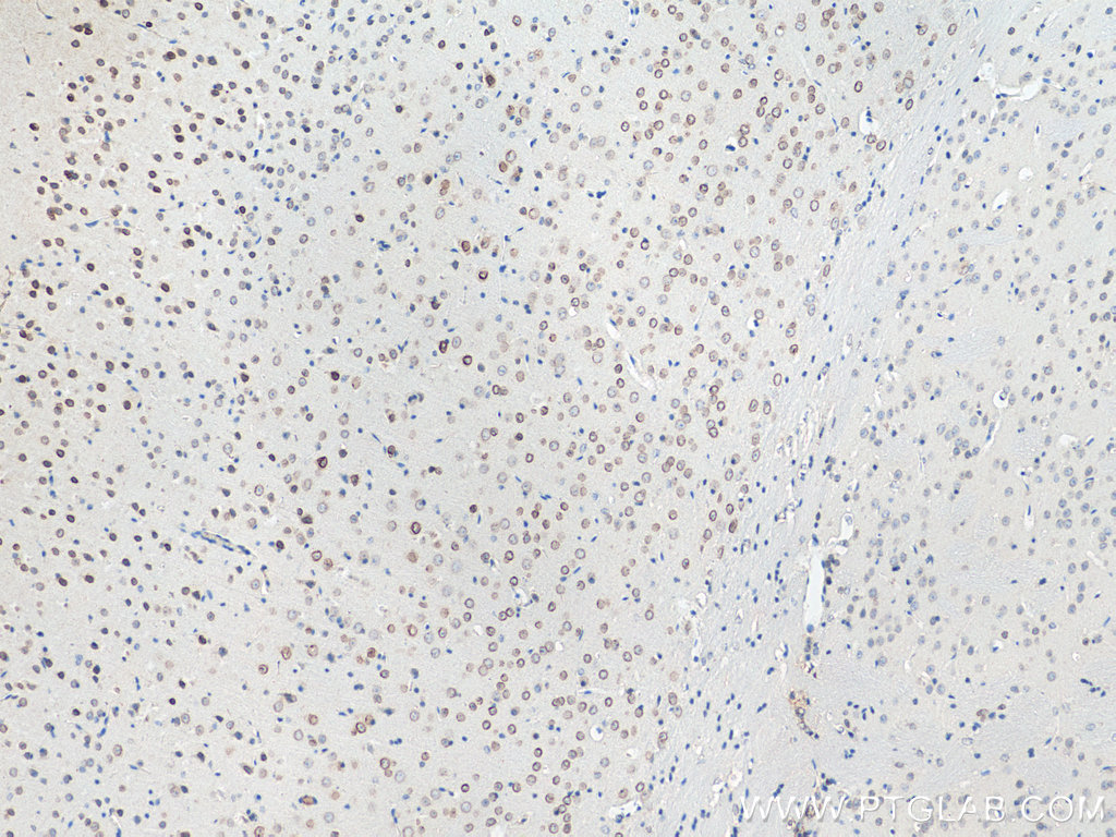 IHC staining of mouse brain using 21921-1-AP