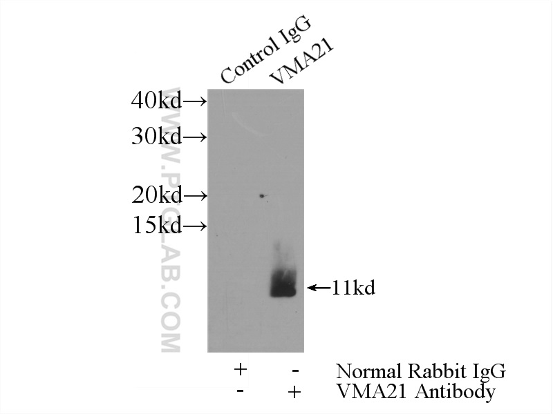 IP experiment of MCF-7 using 21921-1-AP