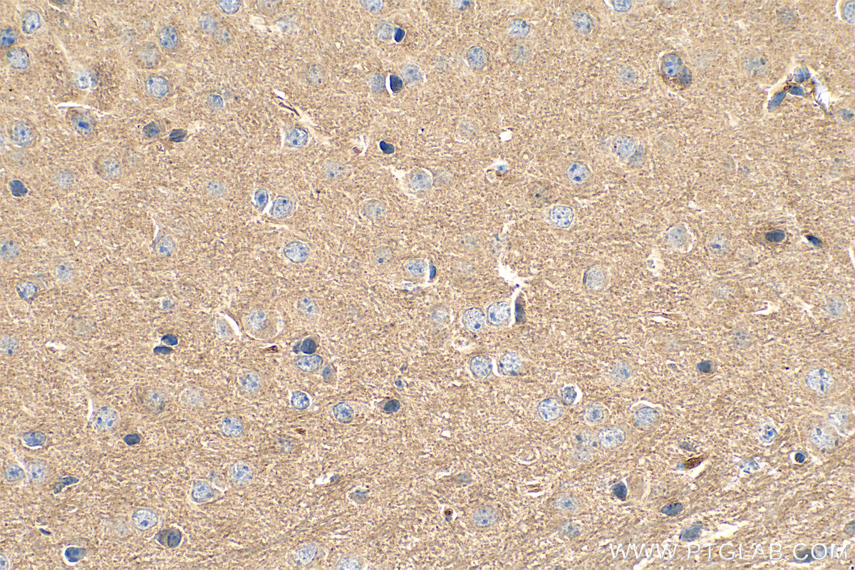 IHC staining of mouse brain using 20873-1-AP