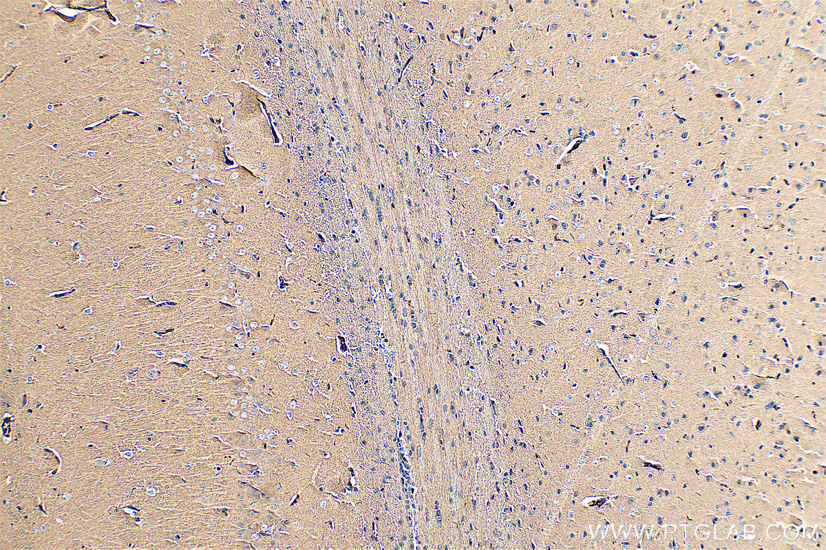 IHC staining of rat brain using 20873-1-AP