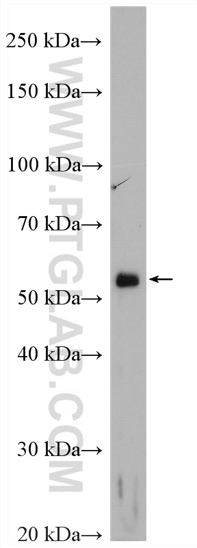 WB analysis of SGC-7901 using 20873-1-AP