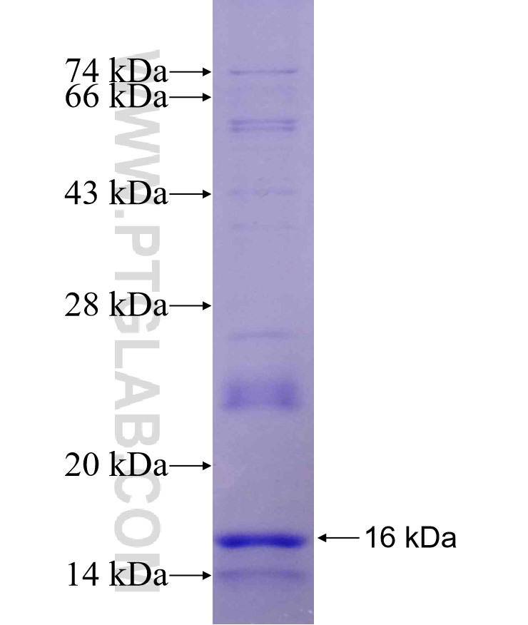 VMAT2 fusion protein Ag15106 SDS-PAGE