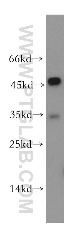 WB analysis of HeLa using 18846-1-AP