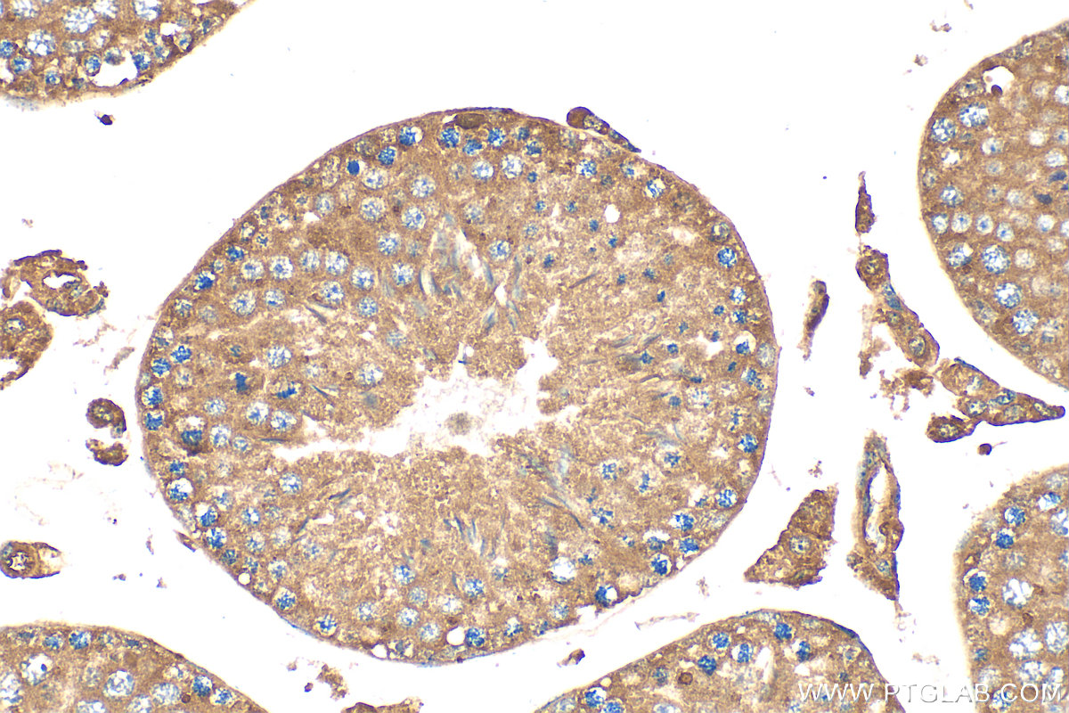 Immunohistochemical analysis of paraffin-embedded mouse testis tissue slide using 20554-1-AP (VN1R5 antibody) at dilution of 1:200 (under 40x lens). Heat mediated antigen retrieval with Tris-EDTA buffer (pH 9.0). IHC staining of mouse testis using 20554-1-AP