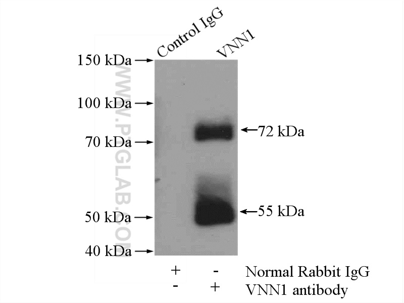 IP experiment of mouse kidney using 21745-1-AP