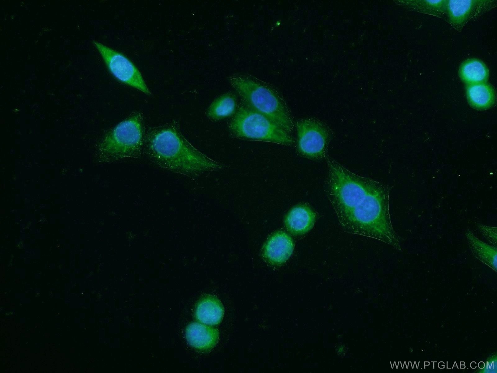 IF Staining of HeLa using 25643-1-AP