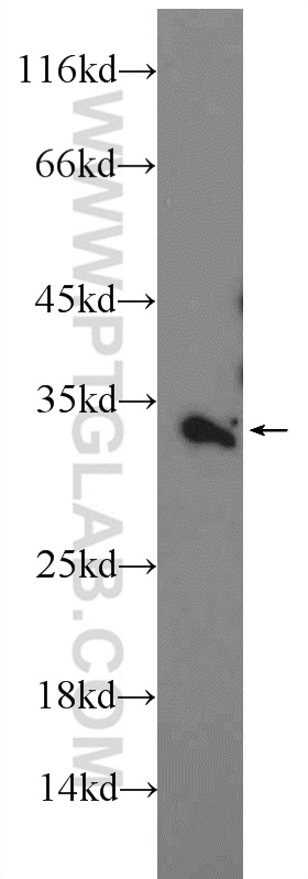 WB analysis of HeLa using 25643-1-AP