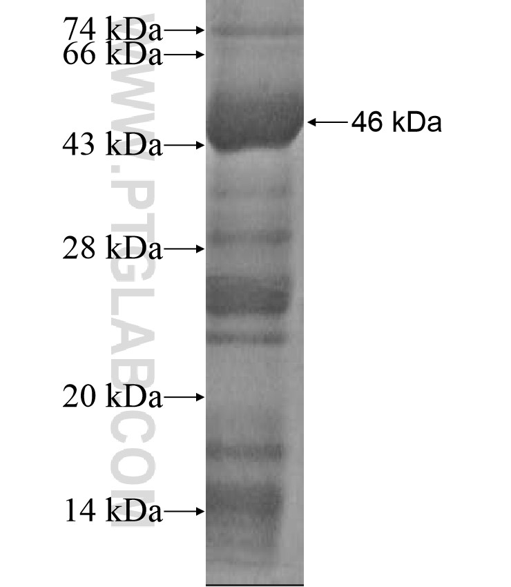 VP7 fusion protein Ag17616 SDS-PAGE VP7 fusion protein Ag17616 SDS-PAGE