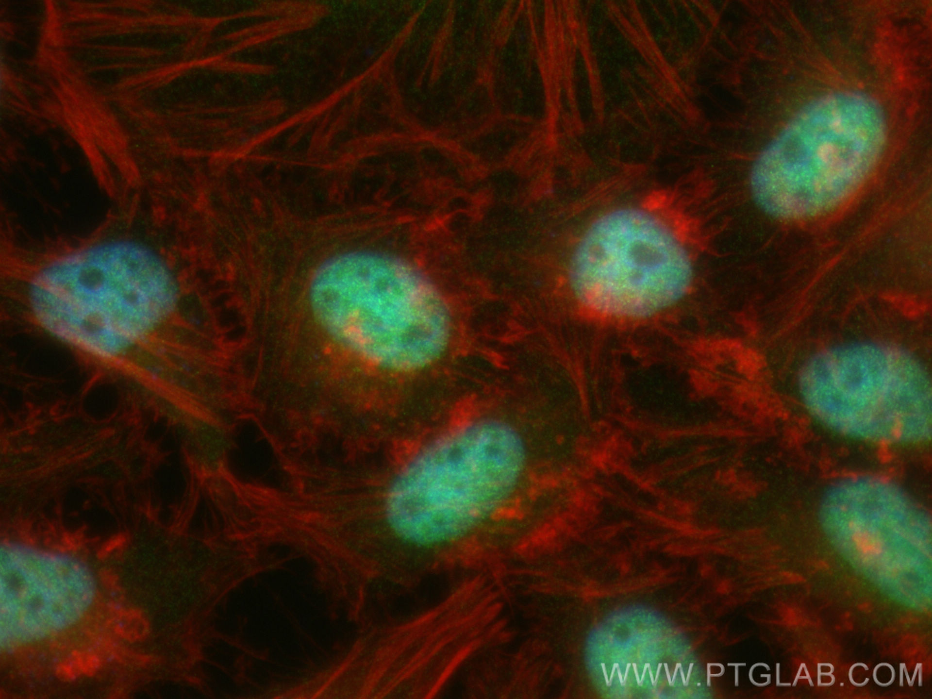 IF Staining of HeLa using 83901-5-RR (same clone as 83901-5-PBS)