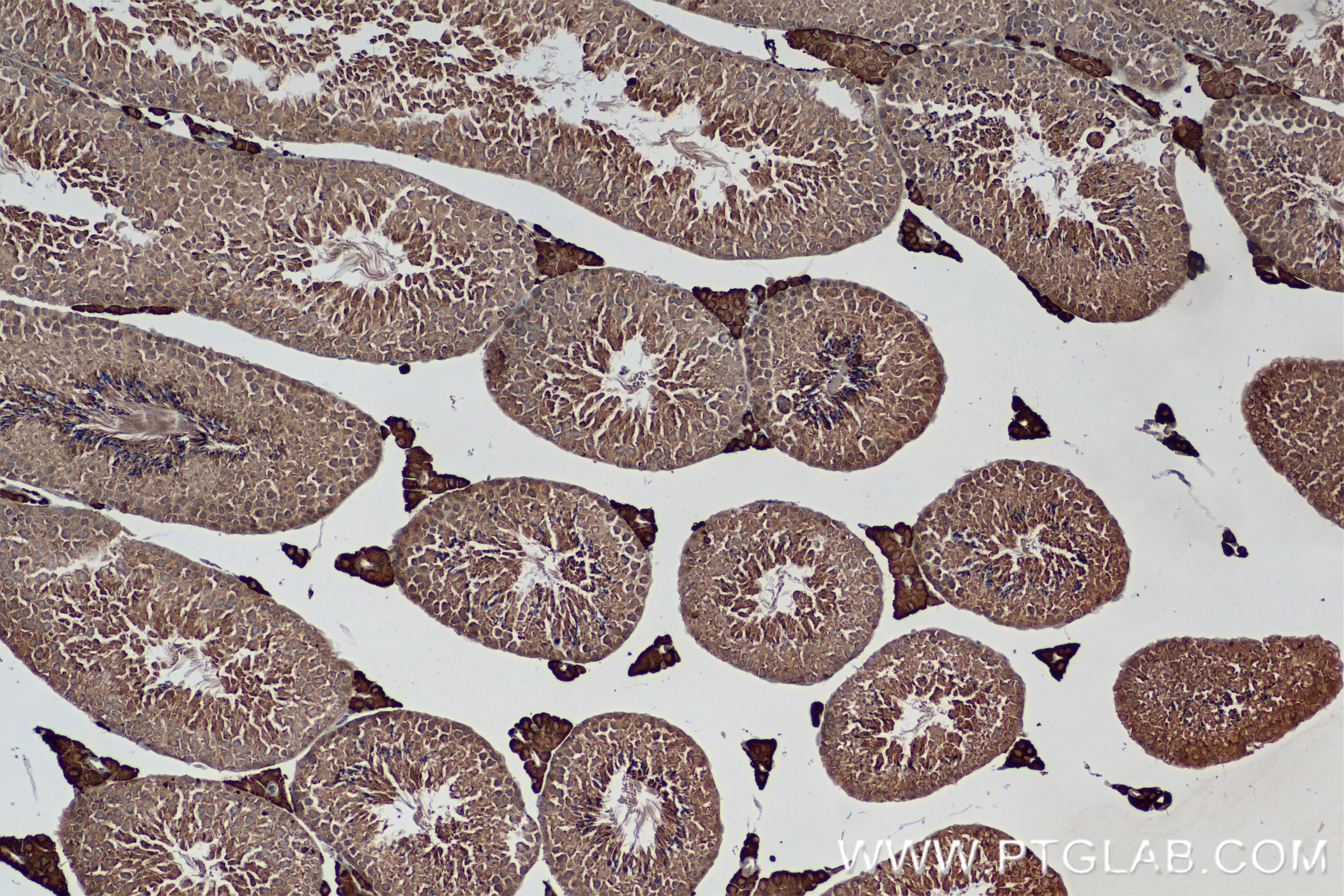IHC staining of mouse testis using 83901-5-RR