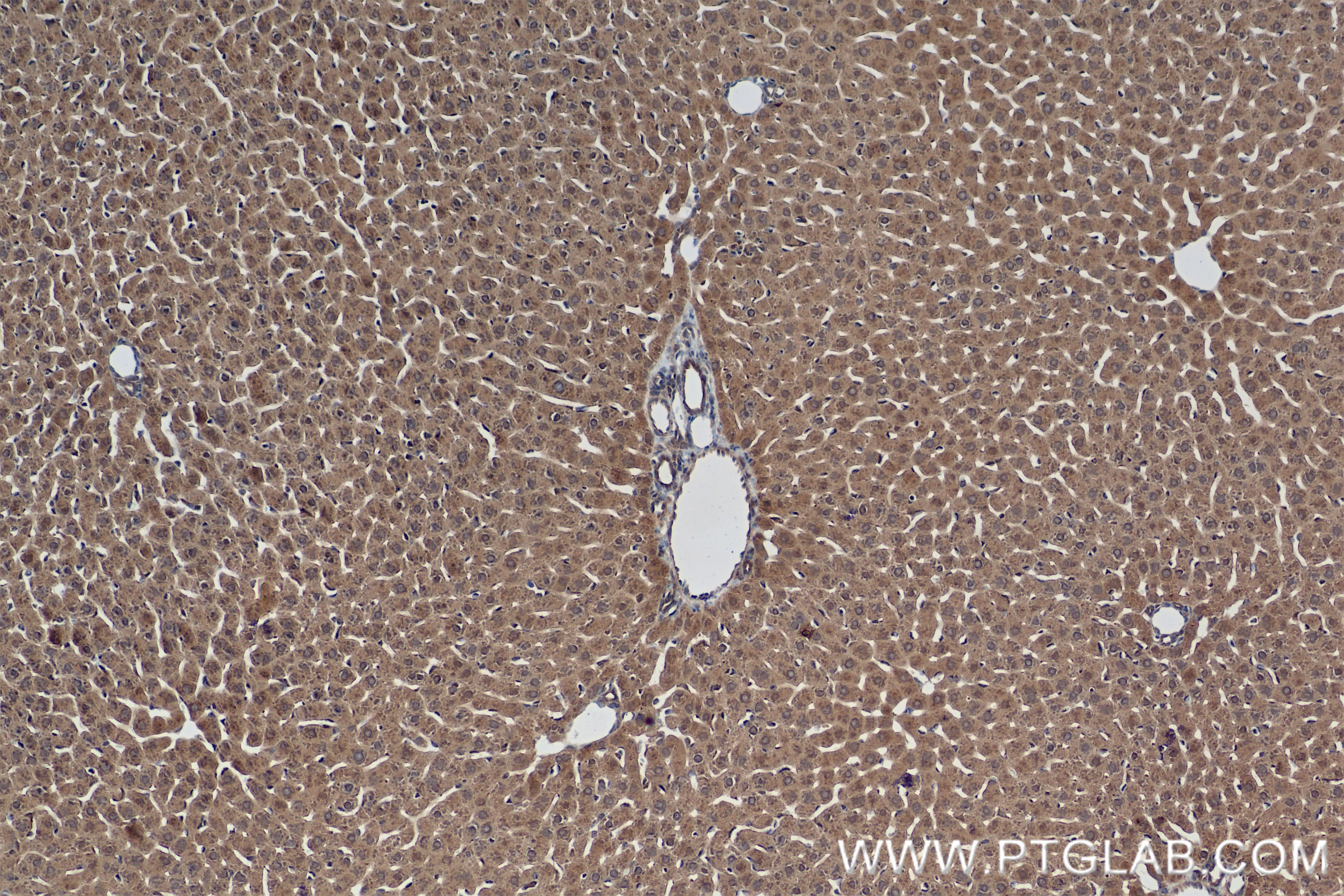 IHC staining of rat liver using 83901-5-RR