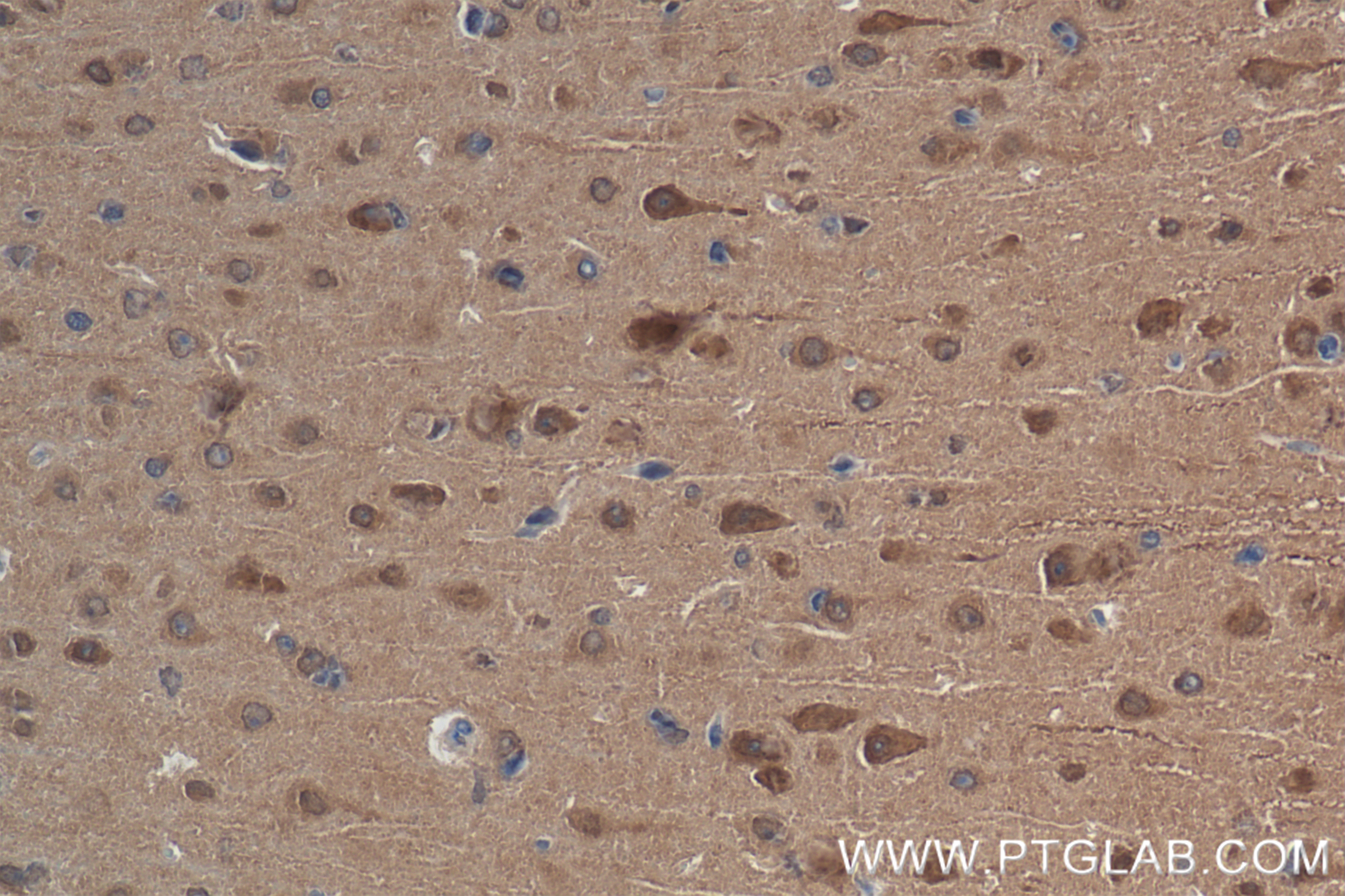 IHC staining of mouse brain using 83901-5-RR