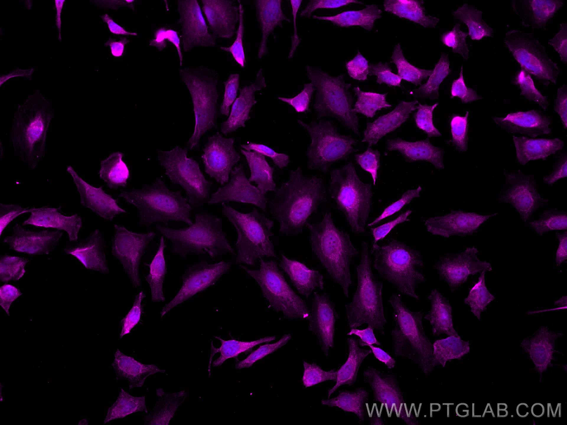 IF Staining of HeLa using CL647-11612