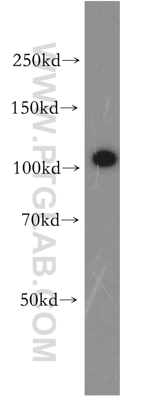 VPS11 Polyclonal antibody