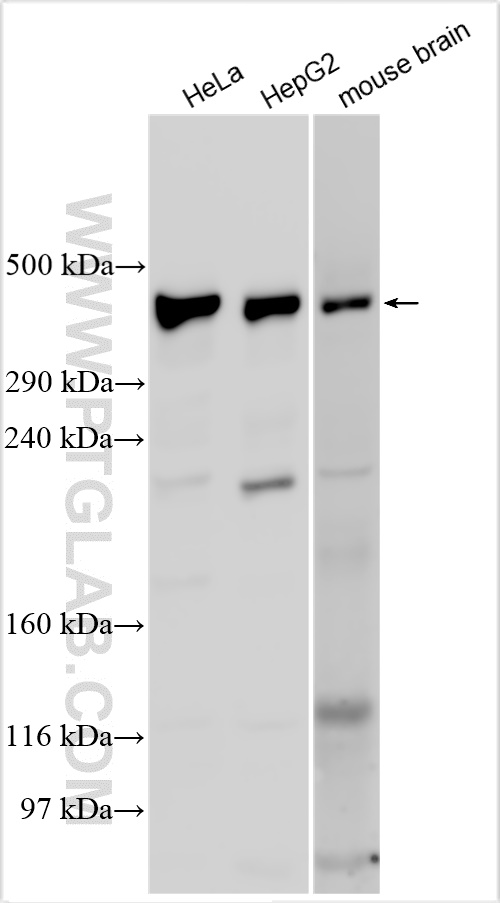 WB analysis using 29844-1-AP