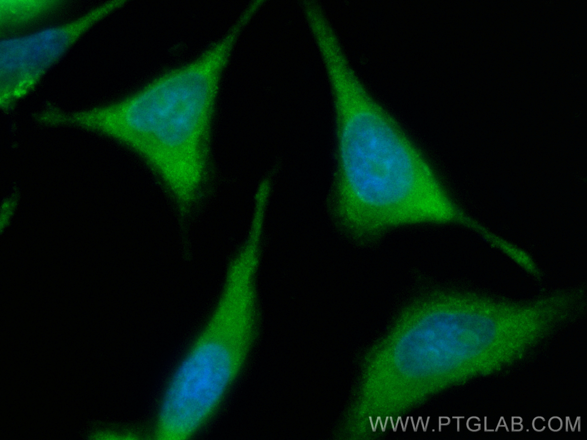 IF Staining of HeLa using CL488-17894