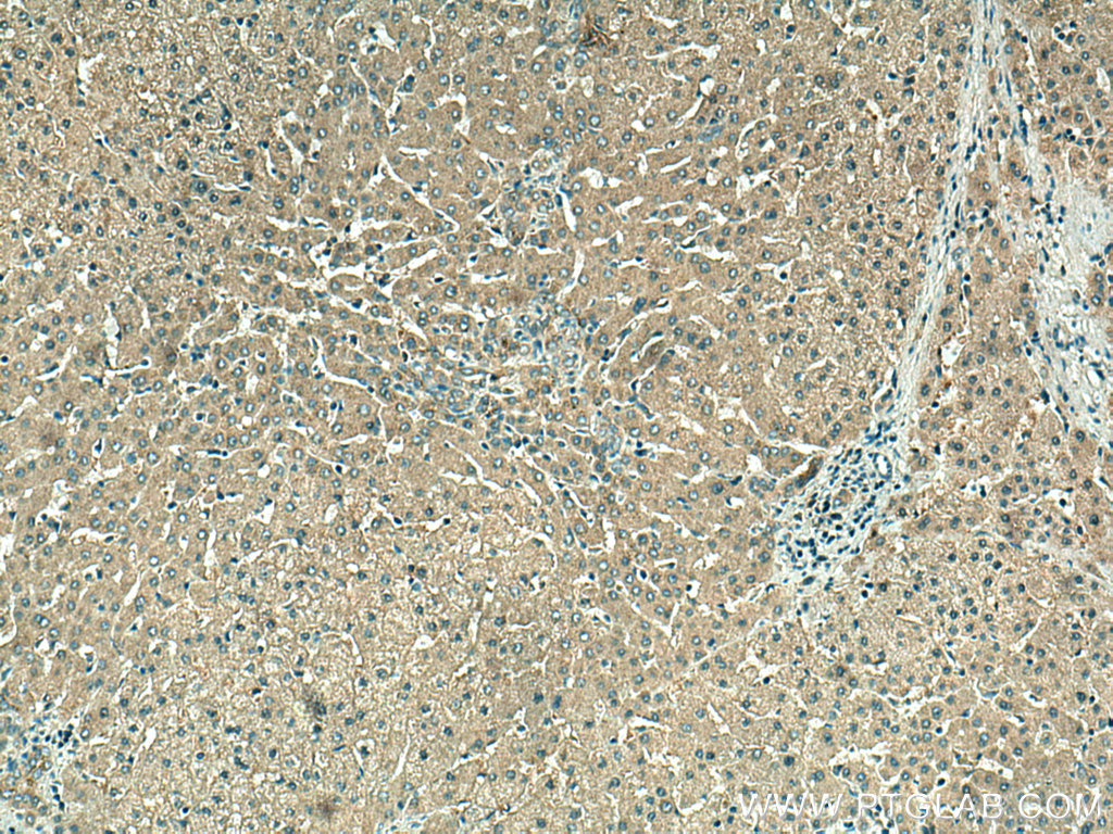 IHC staining of human liver using 17776-1-AP