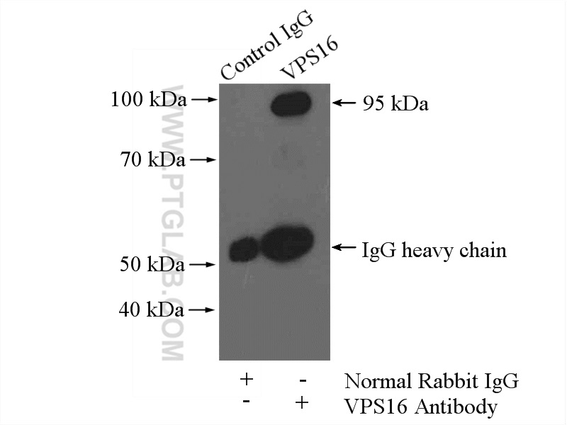 IP experiment of HeLa using 17776-1-AP