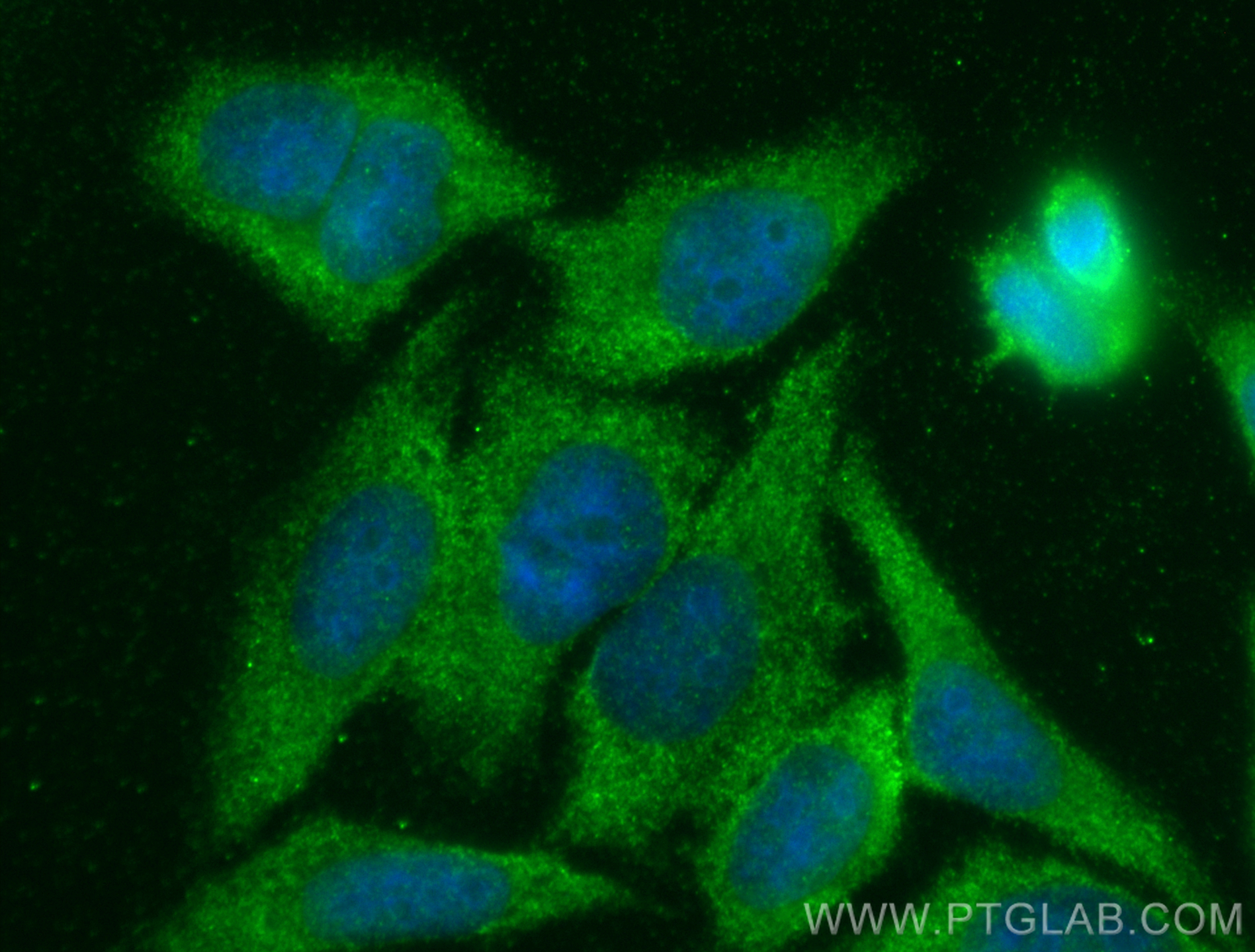 IF Staining of HepG2 using 15472-1-AP
