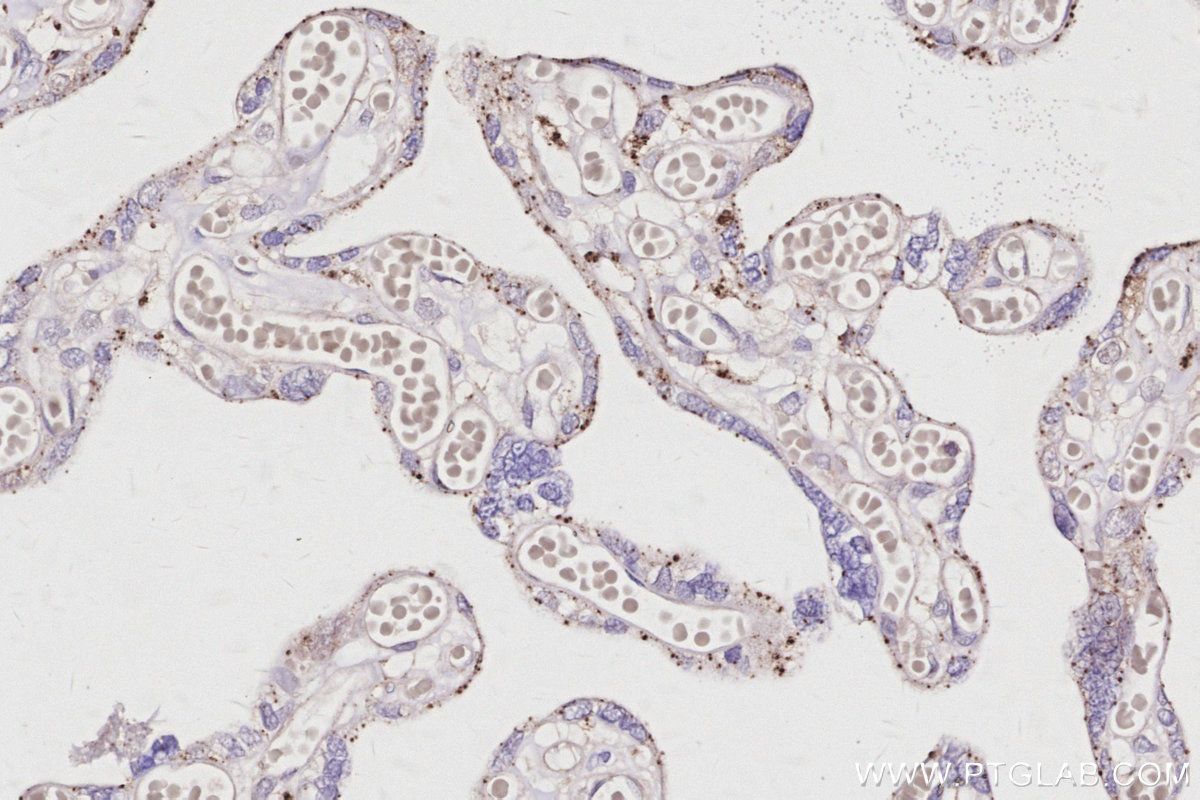 IHC staining of human placenta using 15472-1-AP IHC staining of human placenta using 15472-1-AP