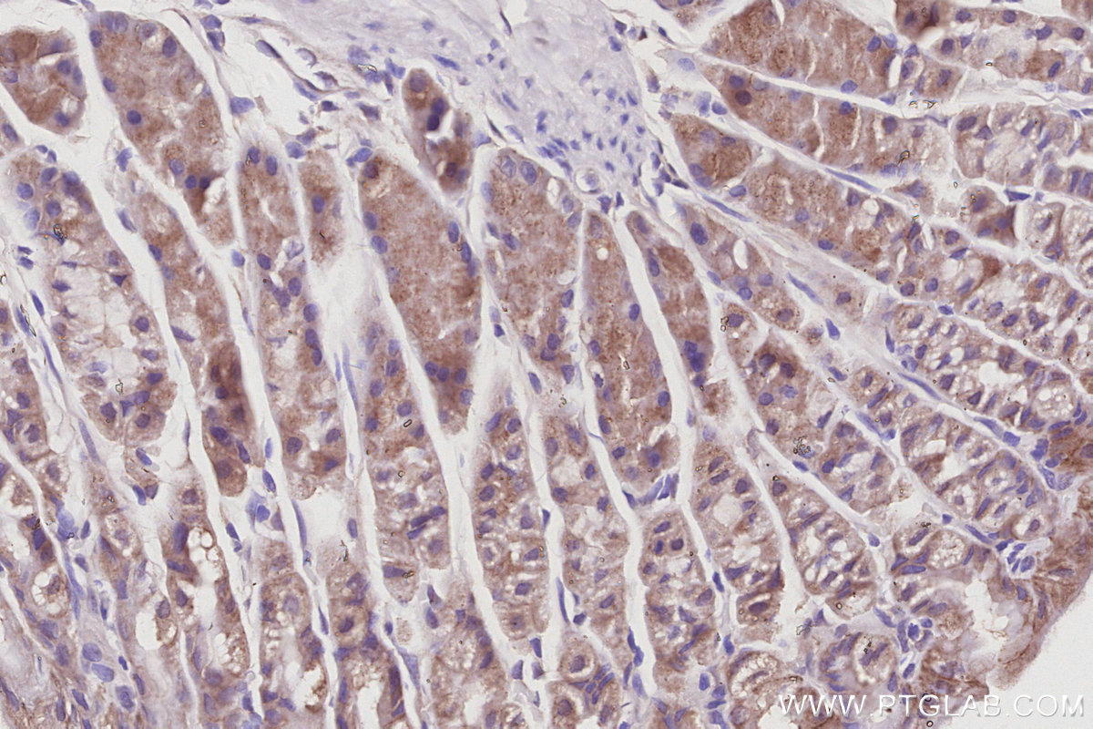 IHC staining of mouse stomach using 15472-1-AP IHC staining of mouse stomach using 15472-1-AP