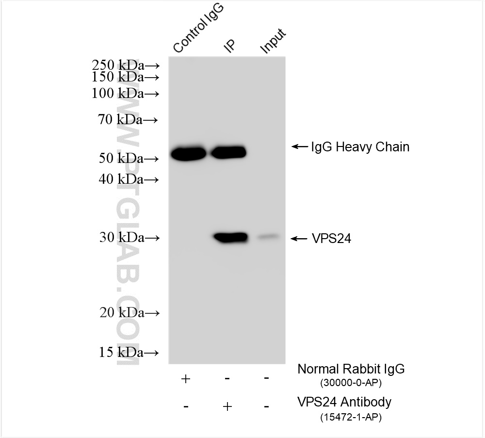 IP experiment of HEK-293 using 15472-1-AP