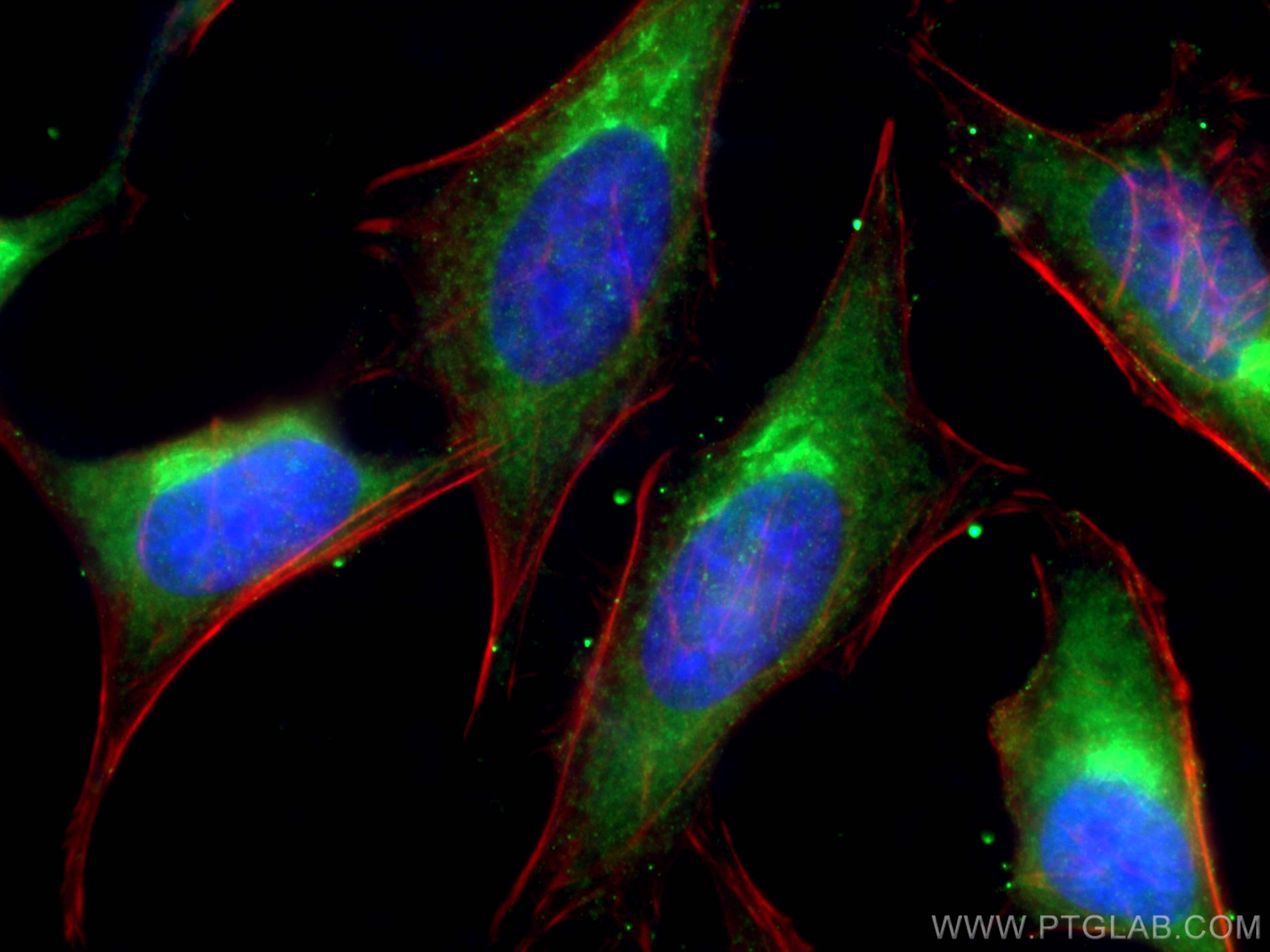 IF Staining of HeLa using 12804-1-AP