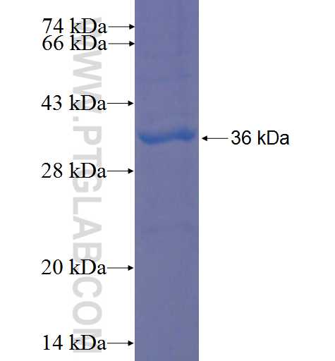 VPS26A fusion protein Ag8297 SDS-PAGE VPS26A fusion protein Ag8297 SDS-PAGE