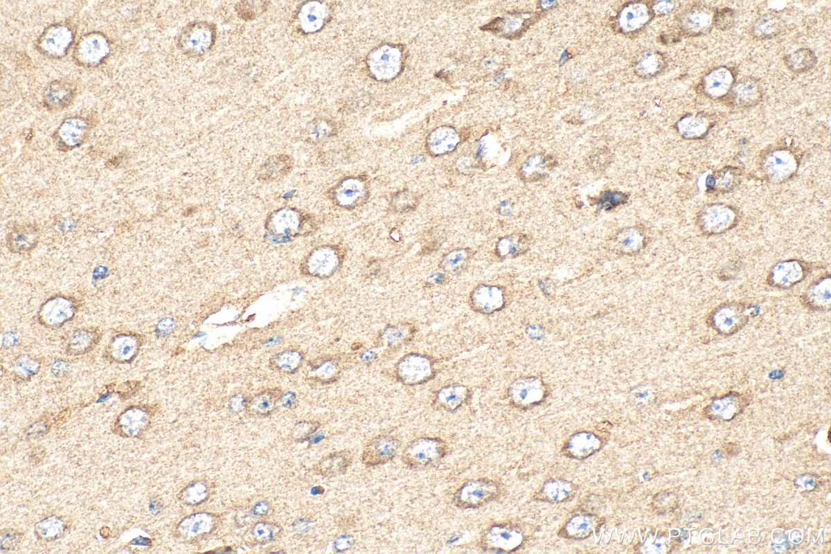 Immunohistochemical analysis of paraffin-embedded mouse brain tissue slide using 15478-1-AP (VPS28 antibody) at dilution of 1:400 (under 40x lens). Heat mediated antigen retrieval with Tris-EDTA buffer (pH 9.0). IHC staining of mouse brain using 15478-1-AP