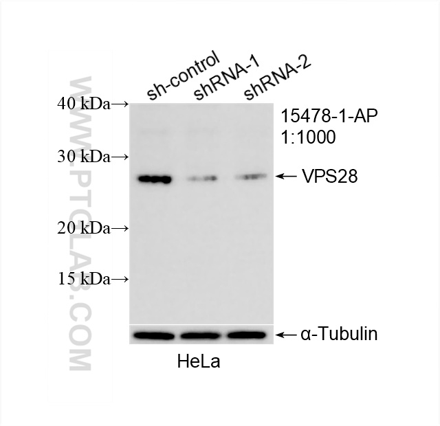 WB analysis of HeLa using 15478-1-AP (same clone as 15478-1-PBS)