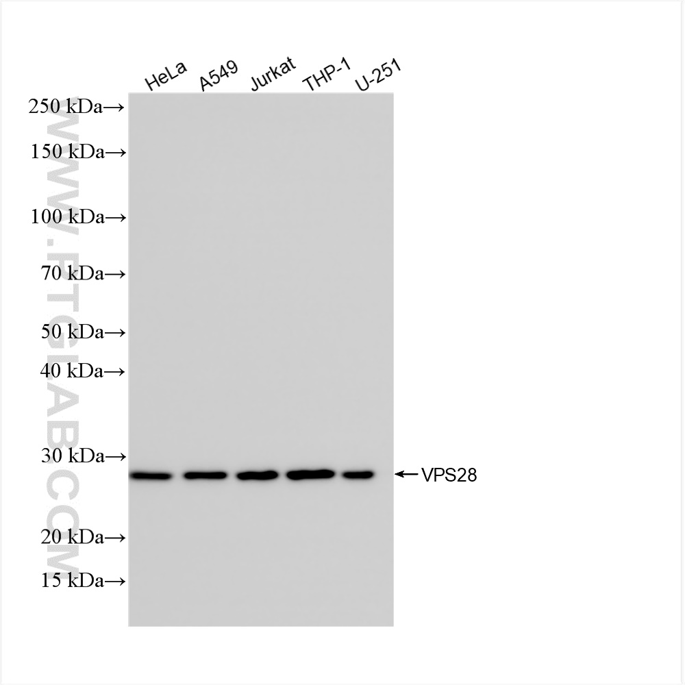 WB analysis using 84472-4-RR