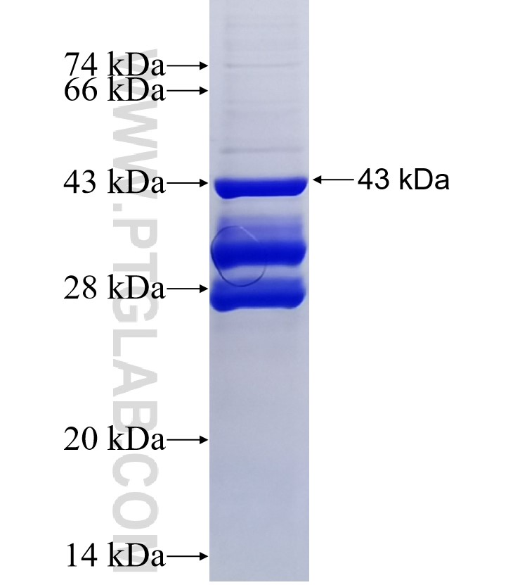 VPS29 fusion protein Ag24939 SDS-PAGE VPS29 fusion protein Ag24939 SDS-PAGE
