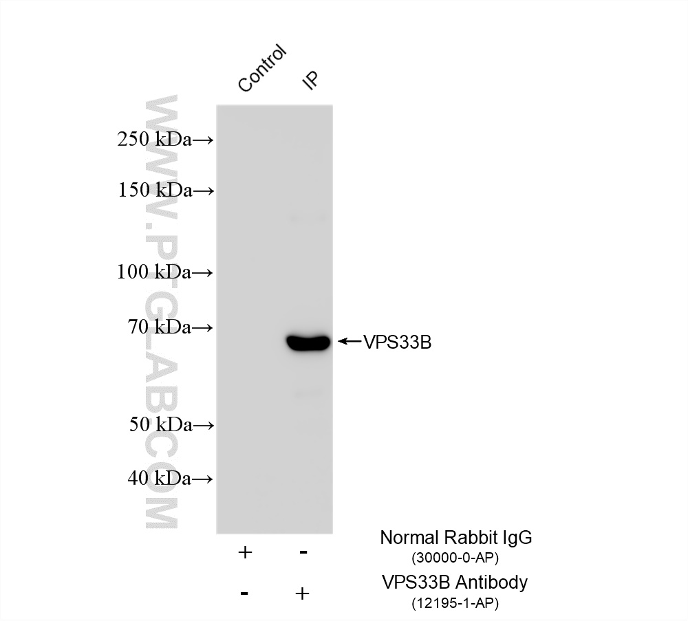 IP experiment of HEK-293 using 12195-1-AP