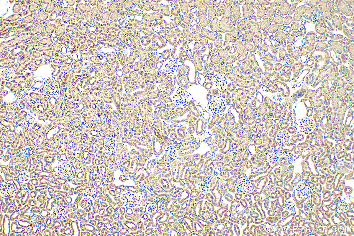 IHC staining of mouse kidney using 28653-1-AP